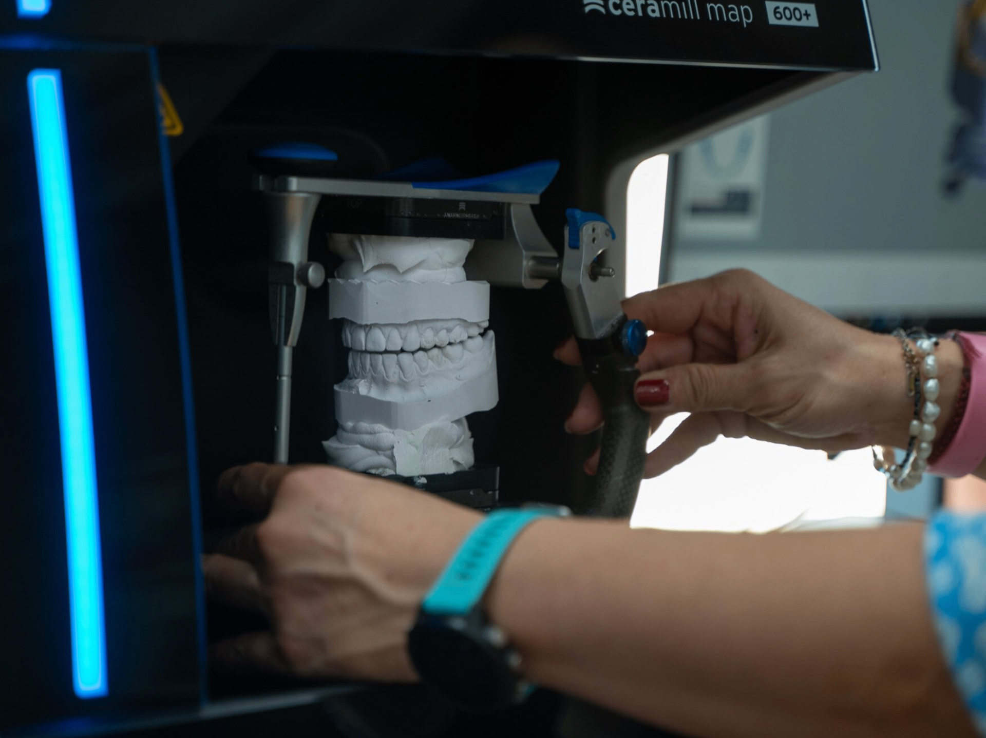 Ceramill map 600+ Scanner mit Gipsmodell